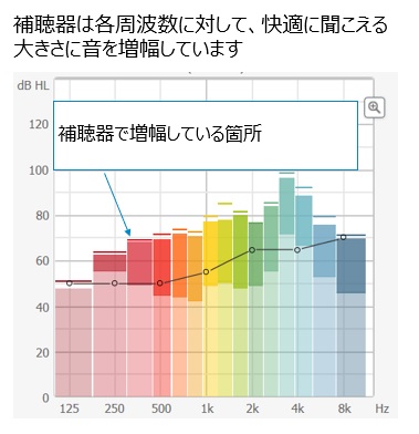 補聴器を着けた場合.jpg