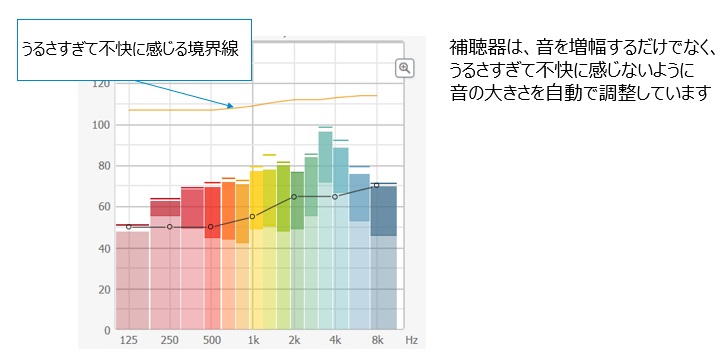 補聴器は大きな音を出さないように音を抑えて耳を守る.jpg